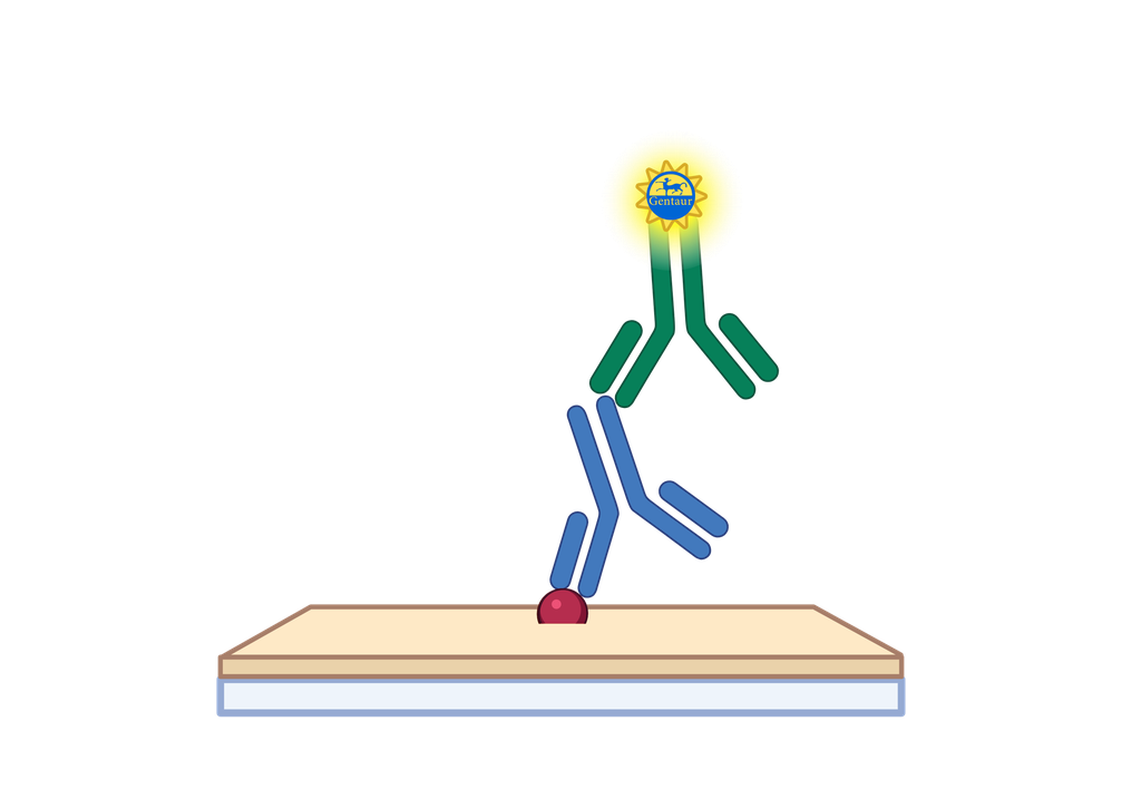 2019-nCoV (S) ELISA, Coronavirus