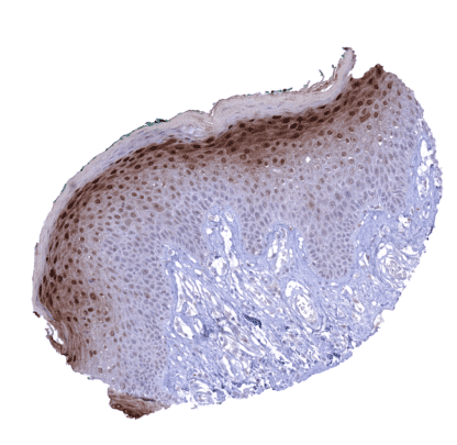 [sk1429] Cystatin A (MSVA-461M)
